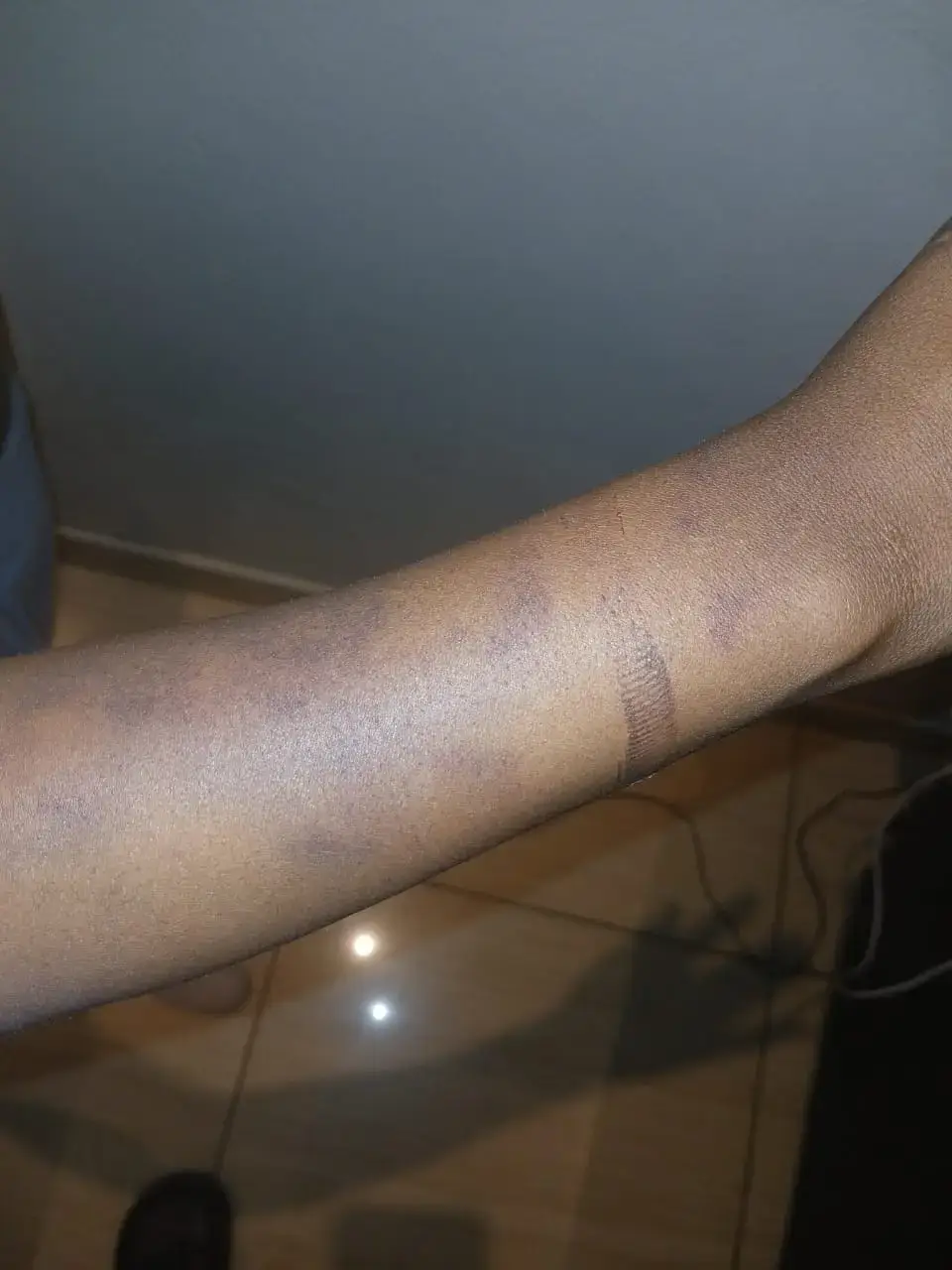 EXCLUSIVE: Mkhwanazi’s thugs kidnapped me and three kids, tortured me for days, says Katiso Molefe’s nephew